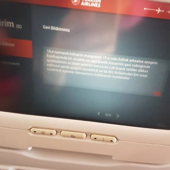 THY Uçak Koltuğundan Ayakkabımın Ucunun Erimesi Bavullarımın Kırılması