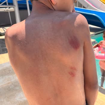 Ramada By Wyndham Tekirdağ Otel Kazası Ve Sorumsuzluk