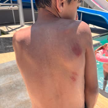 Ramada By Wyndham Tekirdağ Otel Kazası Ve Sorumsuzluk