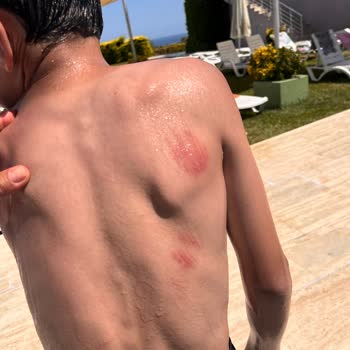 Ramada By Wyndham Tekirdağ Otel Kazası Ve Sorumsuzluk