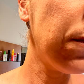 Eda Taşpınar Bomba Güneş Kremi Faciası