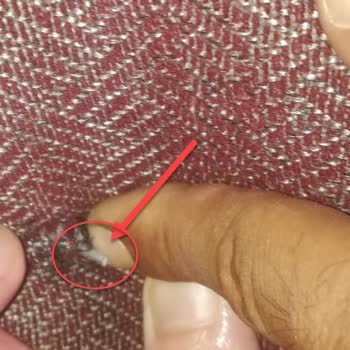 Enza Home Kanepede Otururken Yaralandım!