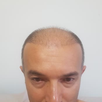 İsveç Klinik Memnuniyetsizlik Ve Fiyasko