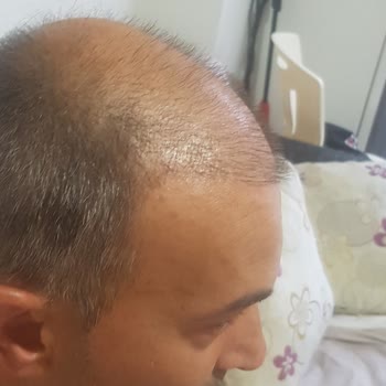 İsveç Klinik Memnuniyetsizlik Ve Fiyasko