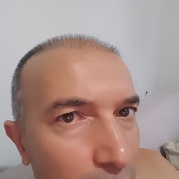 İsveç Klinik Memnuniyetsizlik Ve Fiyasko