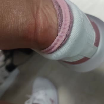 Under Armour Ayağımı Yara Yaptı!