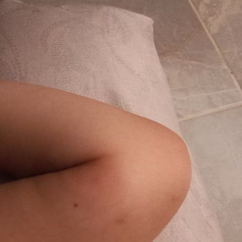 Defans Sinek Kovucu Ürünün Etkisizliği