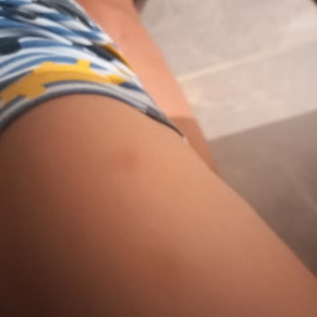 Defans Sinek Kovucu Ürünün Etkisizliği