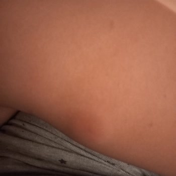 Defans Sinek Kovucu Ürünün Etkisizliği