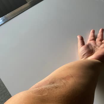 BinBin Frenleri Tutmayan Scooter Ve İhmalkarlığınız!