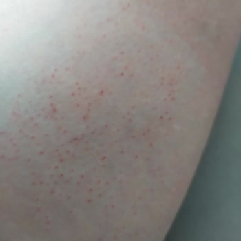 Veet Hassas Ciltler İçin Tüy Dökücü Kremi Üzerinde