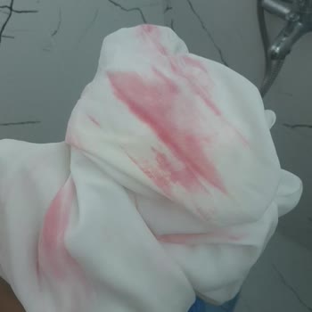 Domestos Beyaz Şalım Kırmızı Oldu!