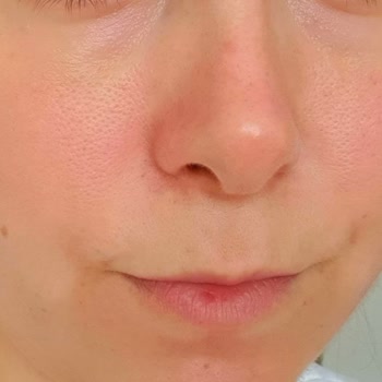 Trendyol Yüzü Kırmızı Boyayan Sorunlu Bakım Serumu