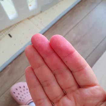 Trendyol Yüzü Kırmızı Boyayan Sorunlu Bakım Serumu