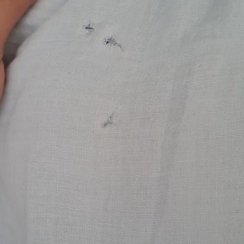 Yurtiçi Kargo Kızımın Elbisesini Yırtılmış Halde Getirdi