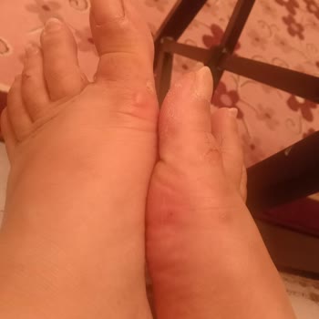 Bambi Ayakkabı Bambi Sağlıksız Ayakkabı