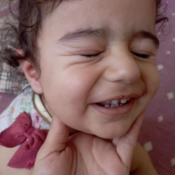 ebebek Tahriş Ve Şiş