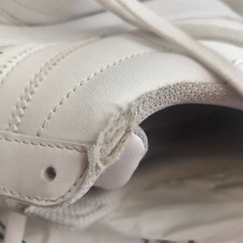 Adidas Ayakkabısı Bilek Kısmı Aşınması