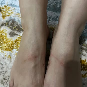 Derimod Terliğin Ayağı Vurması