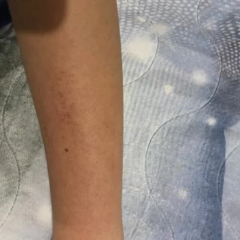 Bee Beauty Ağda Paketi Sorunu