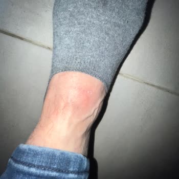 Boyner Ayak Sağlığına Zararlı Ayakkabı