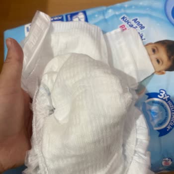 Molfix Bez Bozuk Cıktı
