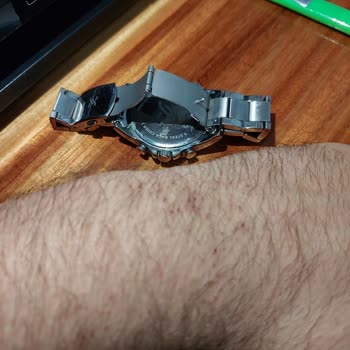 Orijinal Daniel Klein Saat Paslandı Ve Kimyasalı Kolumda Yara Yaptı