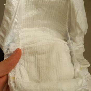 BİM Mağazasından Alınan Molfix Bez Farkı