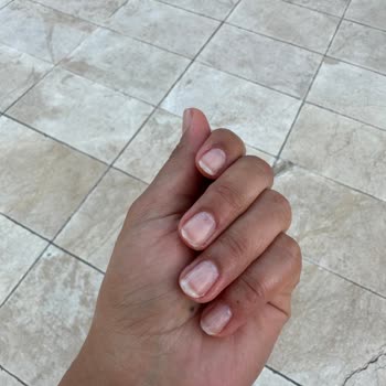 Olga Tırnak Center Çukurambar Mağduriyet