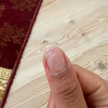 Olga Tırnak Center Çukurambar Mağduriyet