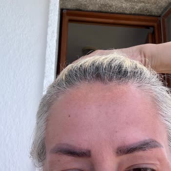 Ayşegül Özdemir Güzellik Merkezi Mağduru