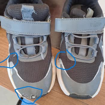 Vicco Ayakkabı Deforme Sorunu