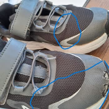 Vicco Ayakkabı Deforme Sorunu