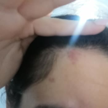Urban Care Mor Nor Alerji Yaptı
