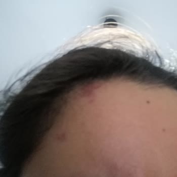Urban Care Mor Nor Alerji Yaptı