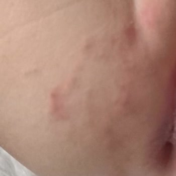 Jenny & Willy Kalitesiz Bebek Bezi