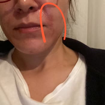 Mine Üstün Güzellik Salonu Kuaför Yüzümü Yaktı