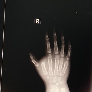 Özel Eryaman Hastanesi'nden Şikayetçiyim