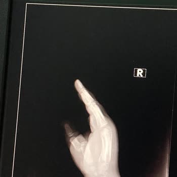 Özel Eryaman Hastanesi'nden Şikayetçiyim