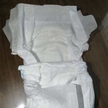 BİM Mağazasından Alınan Molfix Bez Farkı