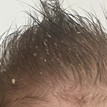 Mustela Pişik Kremi Şampuan Ve Yağ