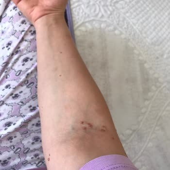 Özel Hatem Hastanesi Hasta Mağduriyeti, Yanlış Tanı