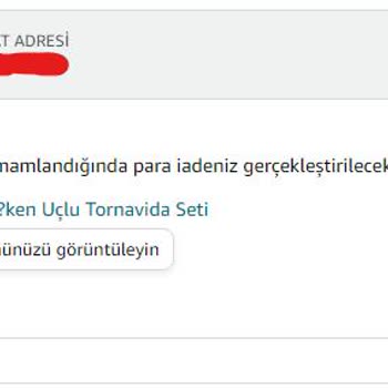 Bir Buçuk Ay Beklettikten Sonra Amazon Kusurlu Ürünü Kabul Etmedi