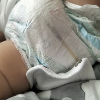 Molfix Bebek Bezi Çis Göstergesi