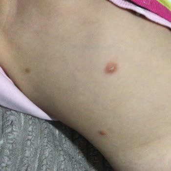 Bebelac Kızımın Vücudu Mahvoldu