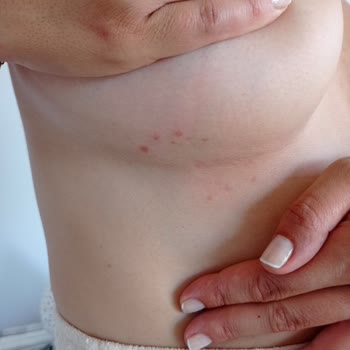 Penti Ürün Malzemesi Yara Yaptı
