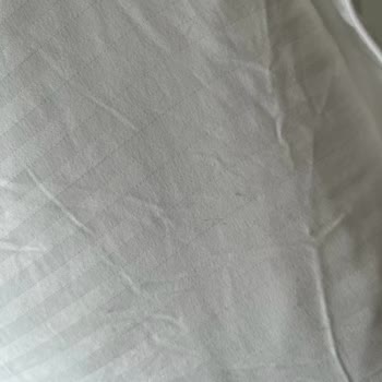 Hotels.com Otelin Hijyen Koşullarından Çok Uzak Bakımsızlığı