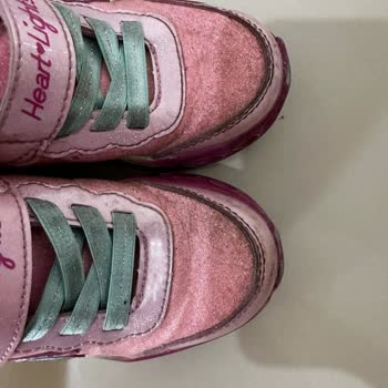 Skechers Ayakkabı Yaşadığım Mağduriyet!