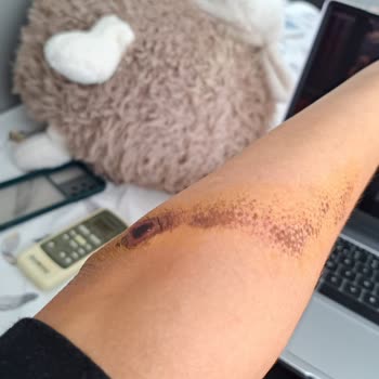 Ahu Hastanesi Acil Servis Hekim İlgisizliği