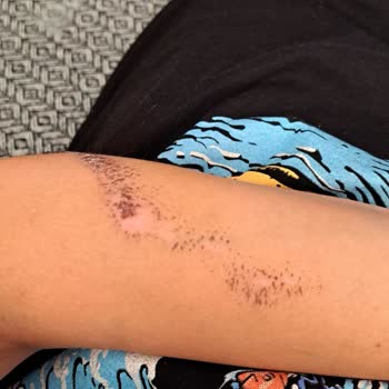 Ahu Hastanesi Acil Servis Hekim İlgisizliği